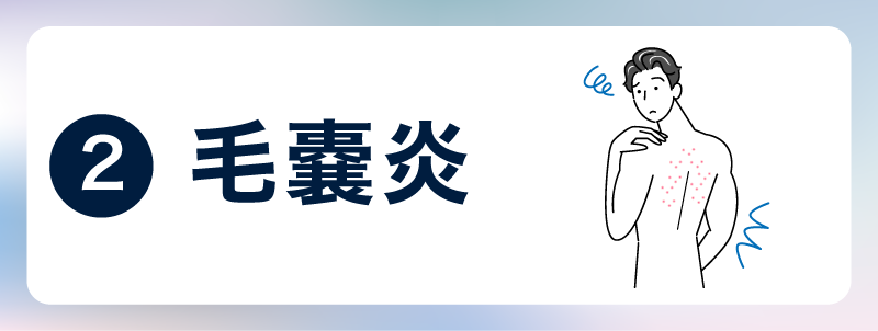 毛嚢炎