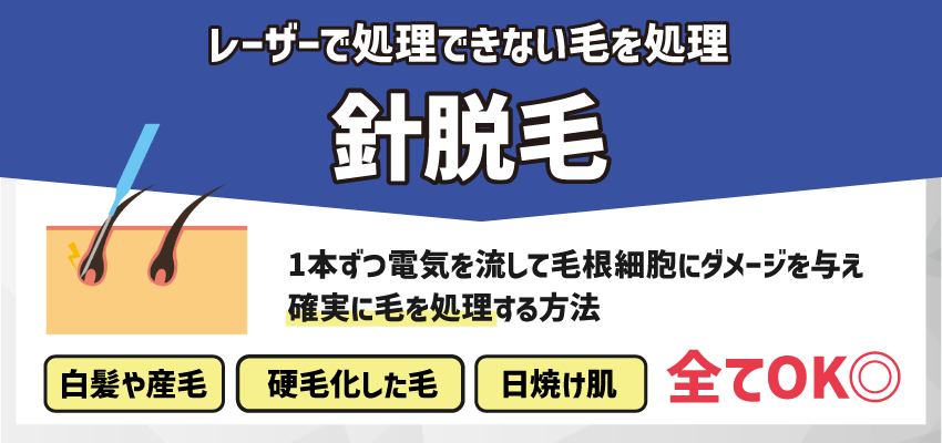 針脱毛