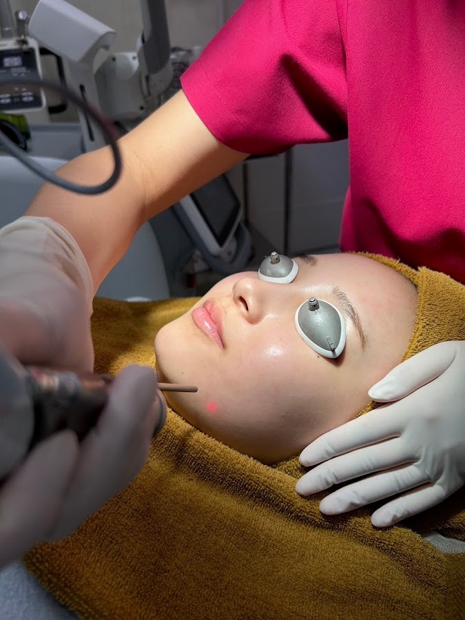 フェミークリニックのレーザー施術風景